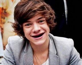 牙齿拔了当明星,牙齿缺失成就明星之路