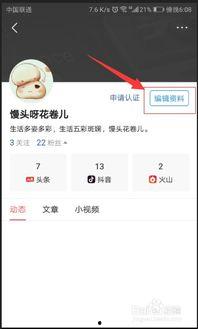 怎样备注头条名称,打造引人注目的标题艺术